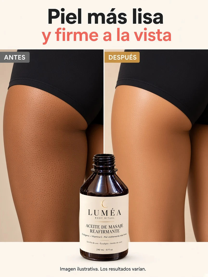 Antes y después ilustrativo. Los resultados varían